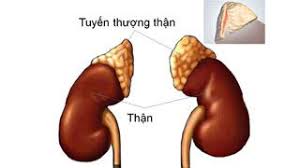 Cường Aldosterone - Hình ảnh minh họa